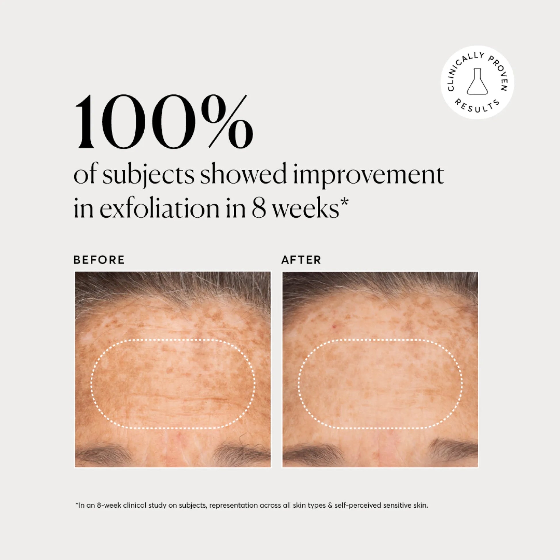 bha-liquid-exfoliant-2-k9 NATR-10027-Alt-Images-BHA-Liquid-Exfoliant-2_-03.webp